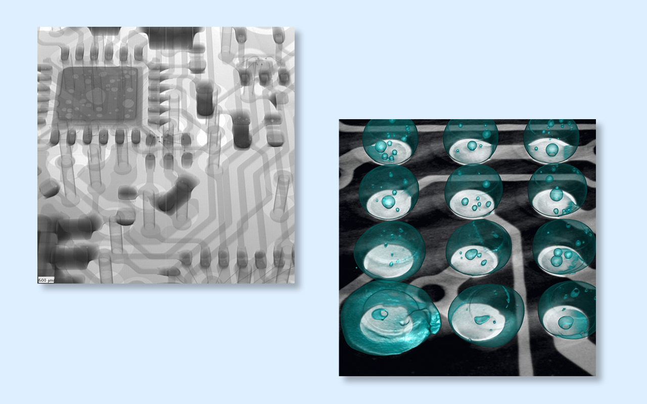 4. 2D vs 3D CT X-ray Which One Do You Really Need? 4. Radiografía por TC 2D o 3D ¿Cuál necesita realmente?