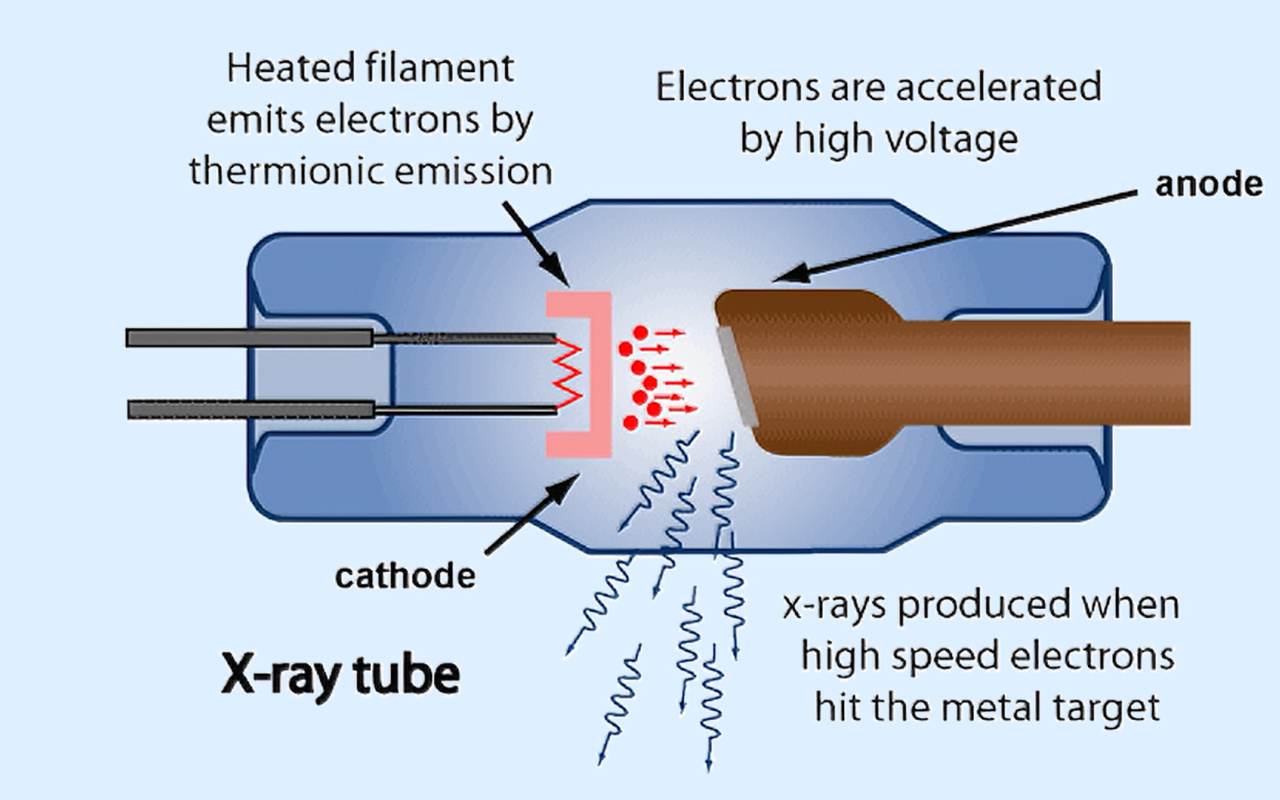 2. What X-ray Technology Actually Does 2. ¿Qué hace realmente la tecnología de rayos X?